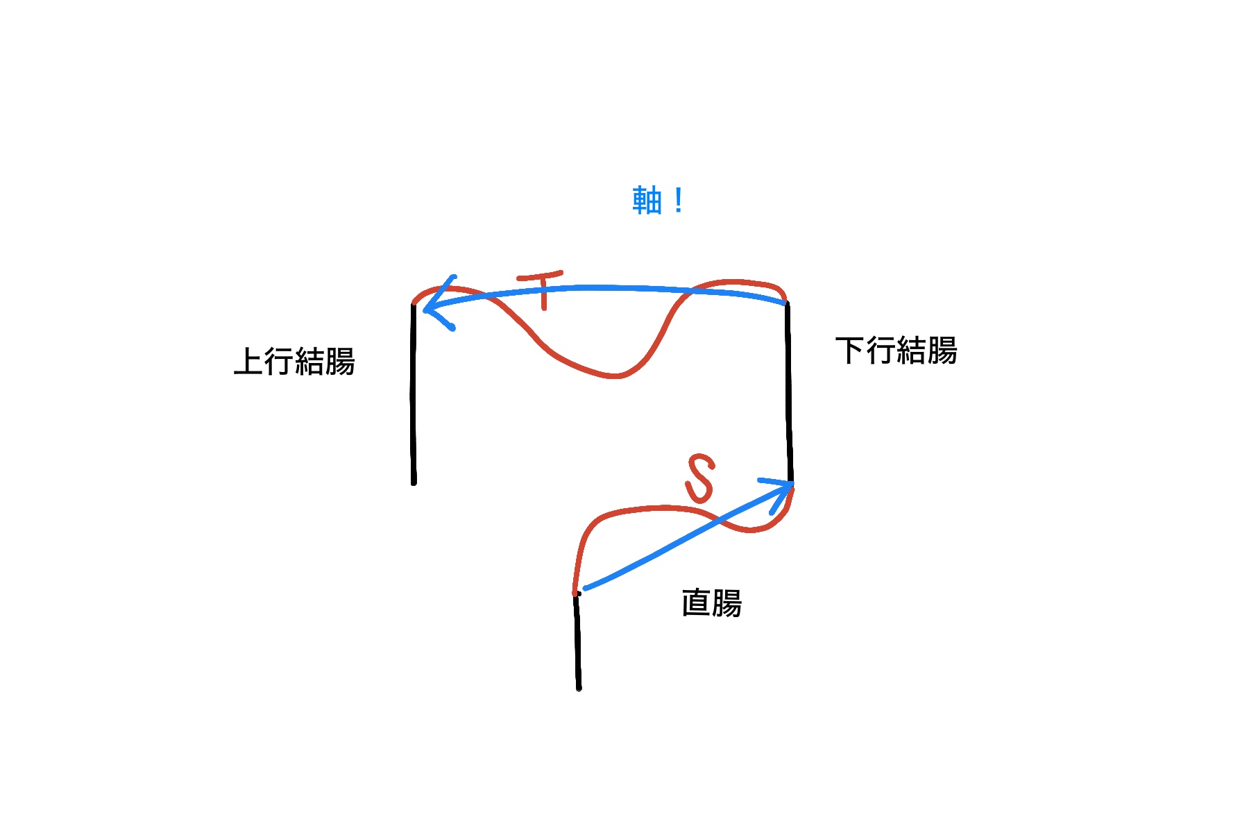 大腸カメラにおける「軸」って、なに？