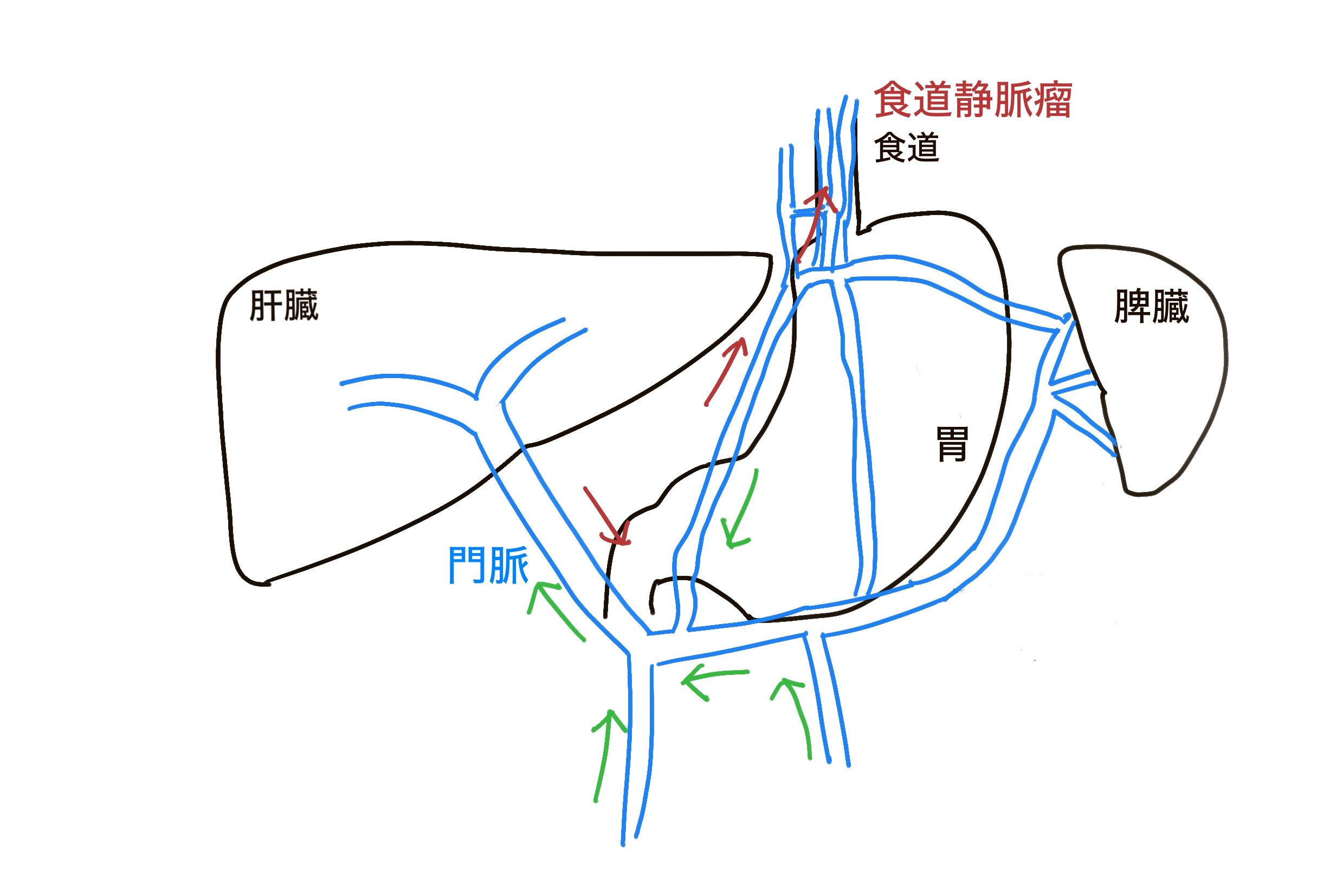 肝臓が悪くなると食道に問題が出る…を説明する図を考える